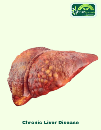 Panchkarma center in Lucknow