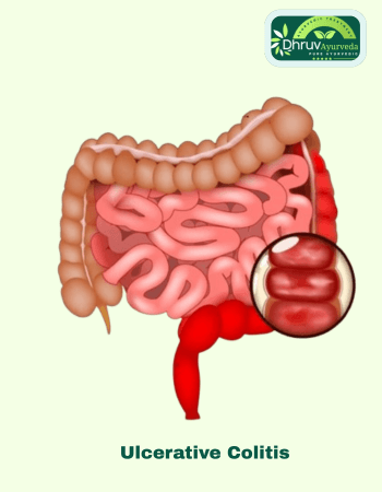 Ayurvedic clinic in Lucknow